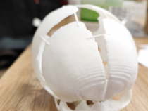 How a 3-D Printout of Newborn Girl's Underdeveloped Skull Saved Infant’s Life