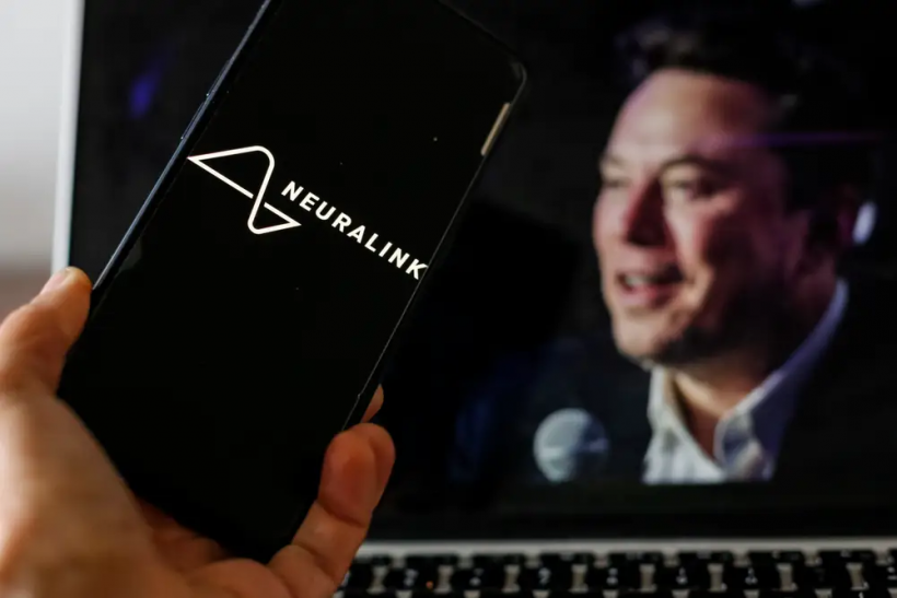 Second Neuralink Brain Implant Surgery May Happen Next Week, Elon Musk Says