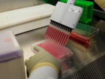 HIV Vaccine That Holds A Promise Of Cure To Be Conducted By Canadian Scientists, Is There A Catch?