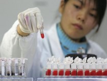 At Long Last! HIV ‘Cure’ Finally Discovered? The Details, Inside