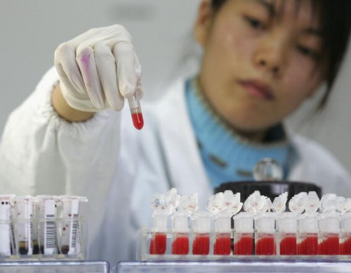 At Long Last! HIV ‘Cure’ Finally Discovered? The Details, Inside
