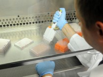 Researchers In Genetic Surgery At Temple University Develop Technique To Eliminate HIV In Human Cells