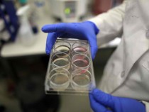 Scientists Continue Stem Cell Research While Courts Debate Ban