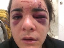 [Fake News] The Real Woman Behind the Viral Photo of 'Aracely Henriquez' Allegedly Assaulted by George Floyd Speaks Up